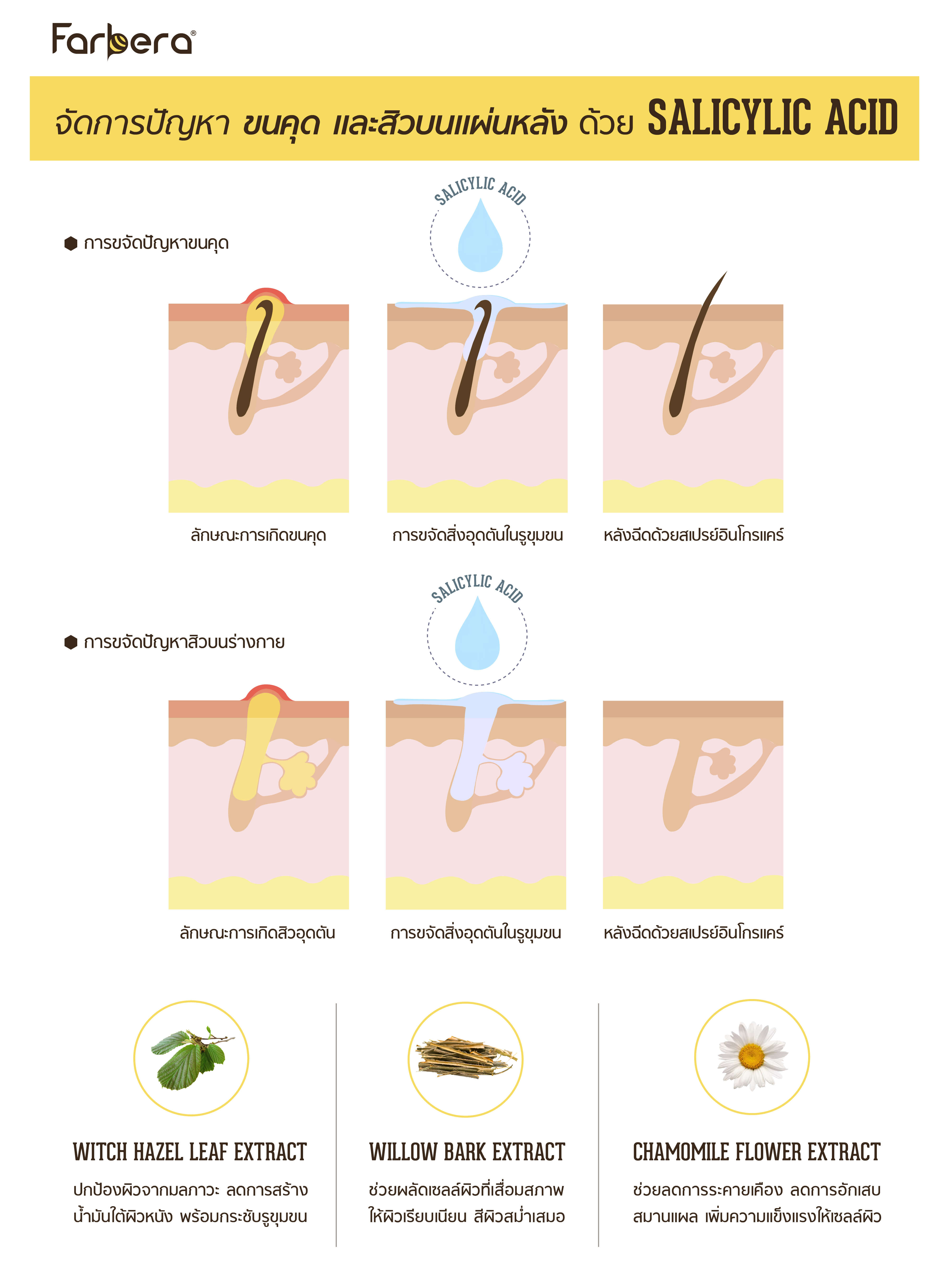 farbera, Ingrow Care, สเปรย์ช่วยป้องกันขนคุด, สเปรย์ป้องกันสิวที่หลัง