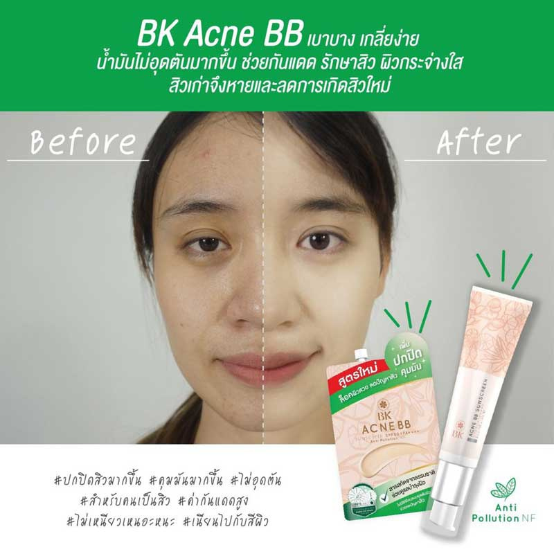 BK Mask Sensi Foundation Acne BB SPF50+ PA++++ รีวิว